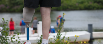 person with prostetic leg