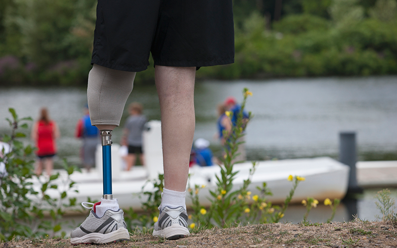 person with prostetic leg