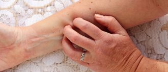 Learn more about psoraisis