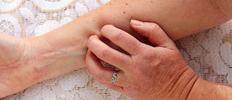 Learn more about psoraisis