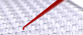 blood work