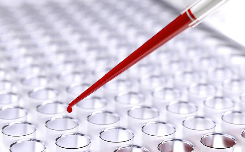 blood work