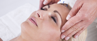 acupuncture