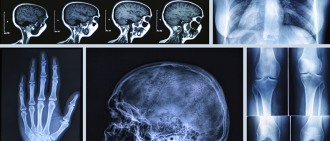 x-ray imaging
