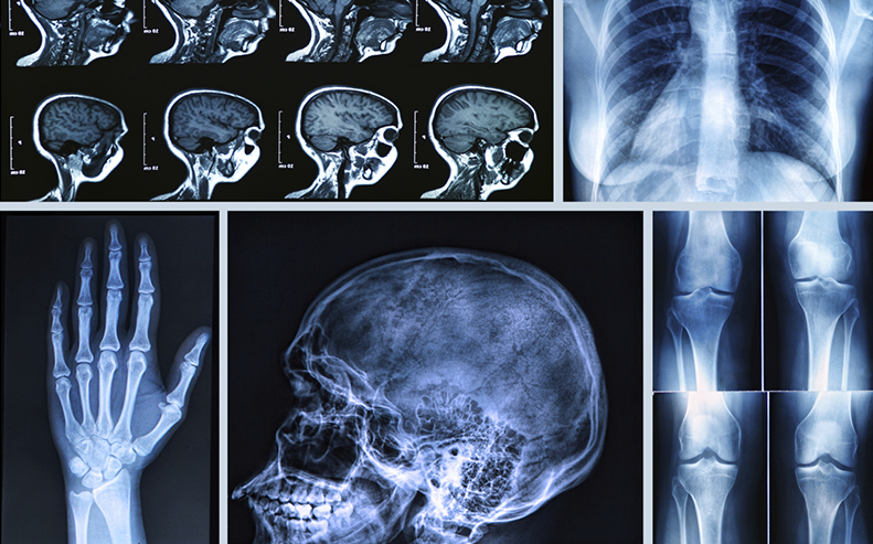 x-ray imaging
