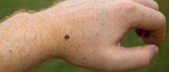 tick on hand