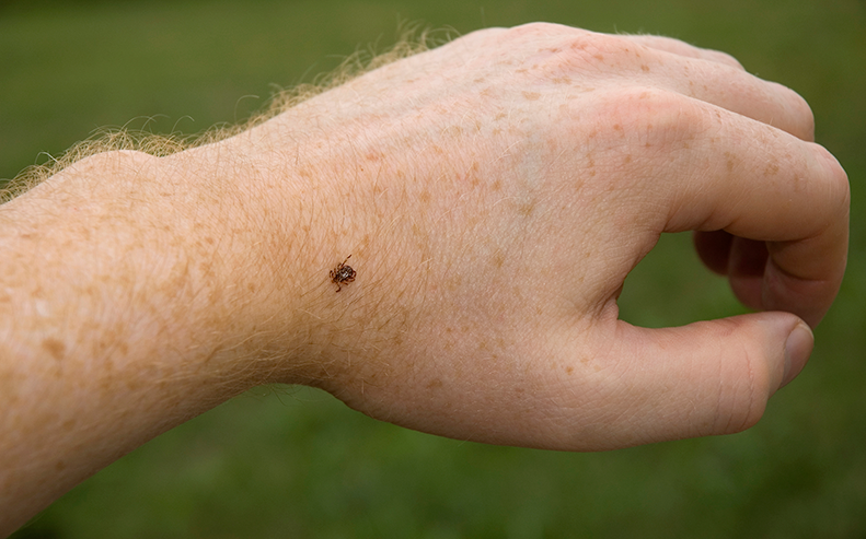 tick on hand