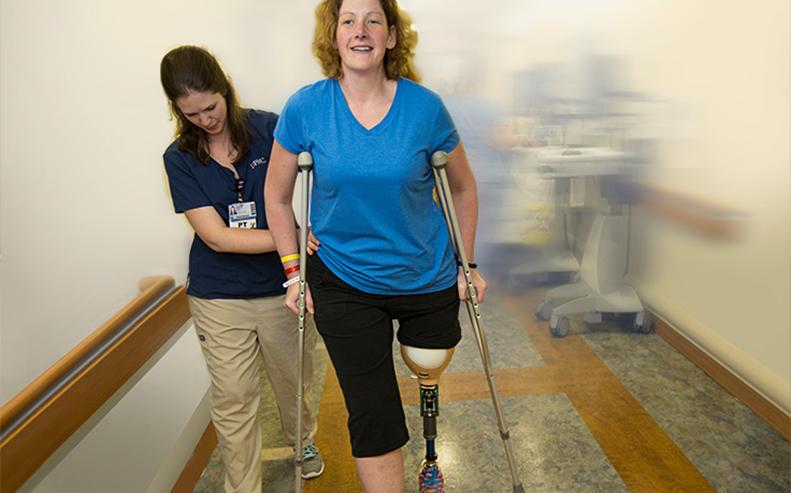 prosthetic leg upmc