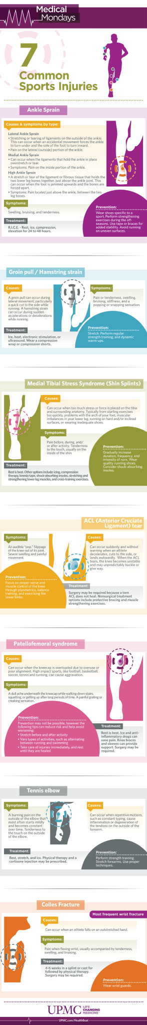 Learn more about the symptoms, treatment, and prevention for the most common sports injuries. 
