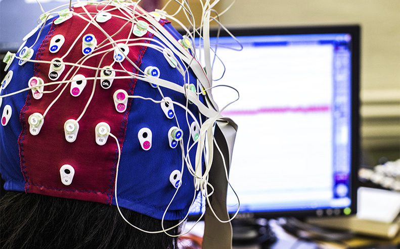 brain mapping