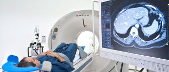 radiation therapy