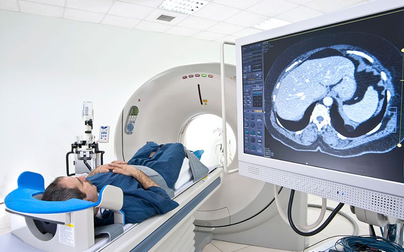 radiation therapy