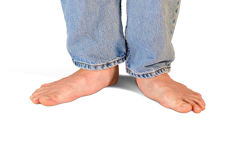flat feet