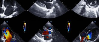 The results of an echocardiogram.