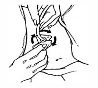 An illustration on keeping your stoma site clean.
