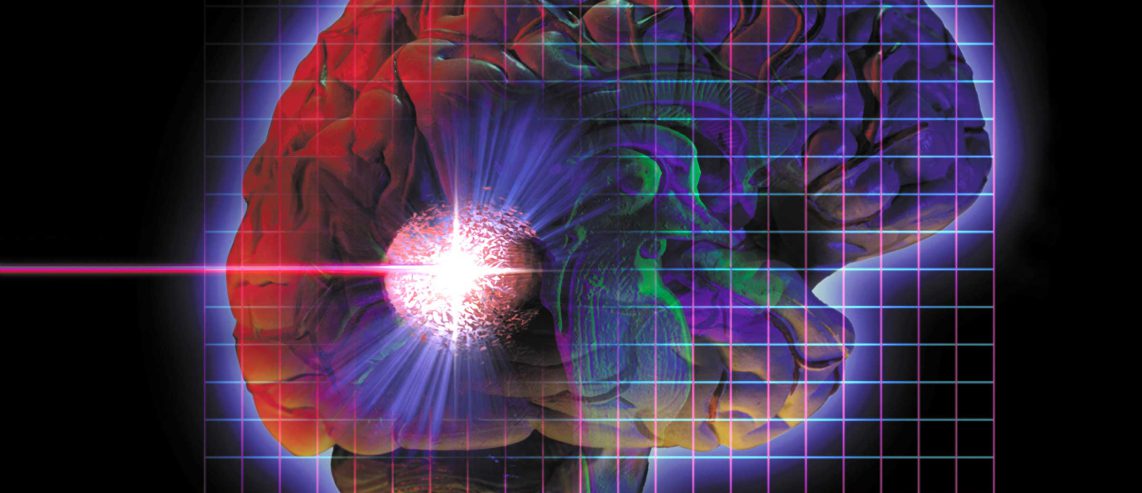 gamma knife radiosurgery treatment options
