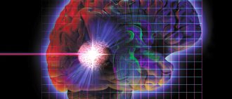 gamma knife radiosurgery treatment options