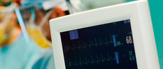 heart monitor during surgery