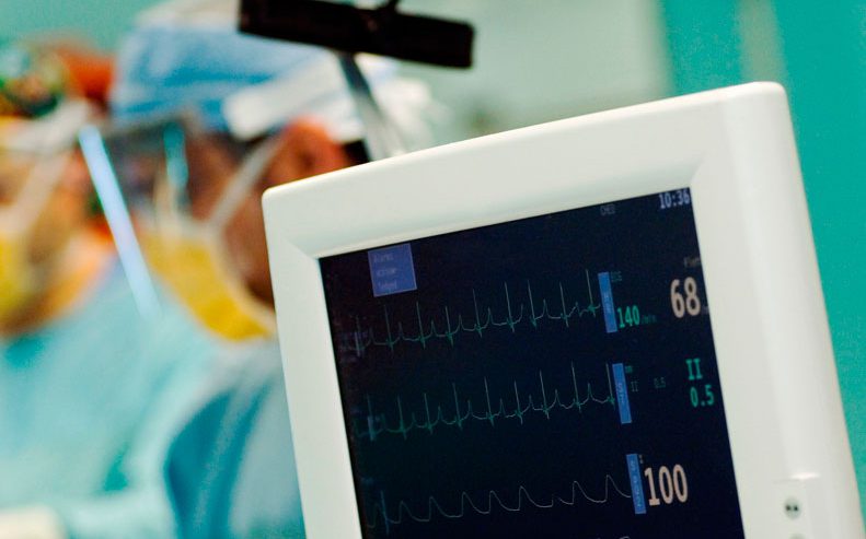 heart monitor during surgery