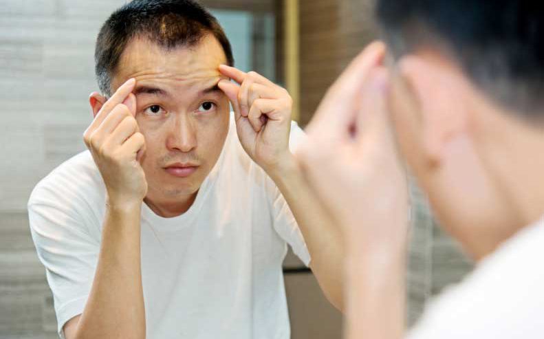 Learn more about the connection between acne and the hormone testosterone