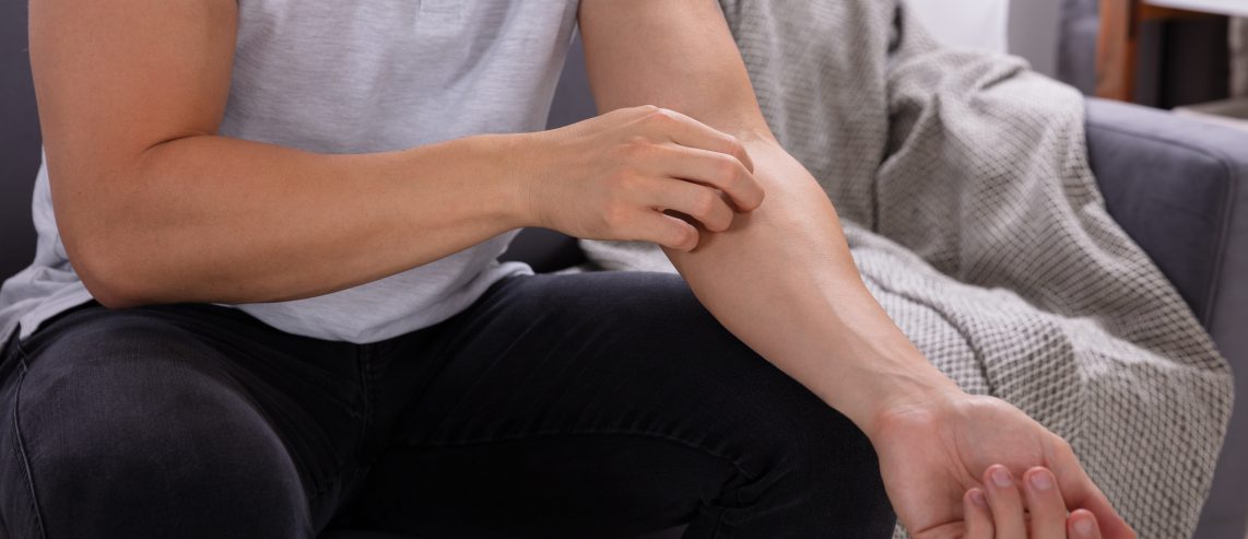 Learn more about treating psoriasis at home.