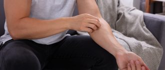 Learn more about treating psoriasis at home.
