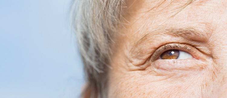 ways to prevent wrinkles
