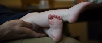 Hand, foot, and mouth disease is a common illness among children under age 5