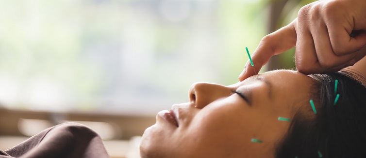 Learn more about acupuncture