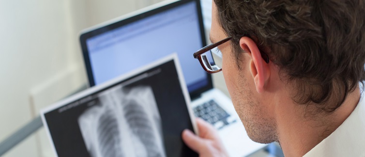 Learn about lung nodules