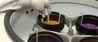 What is blood count?