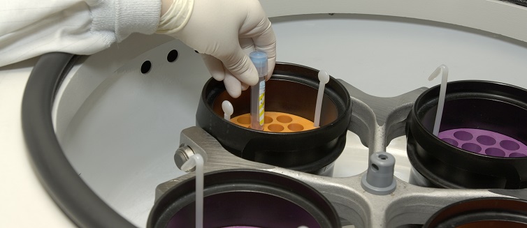 What is blood count?