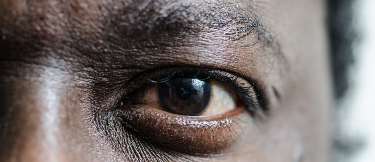Learn more about eye transplant.