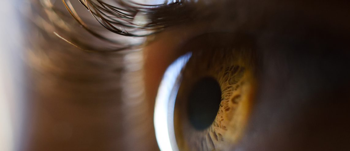 Learn more about innovative treatments for uveal metastatic melanoma