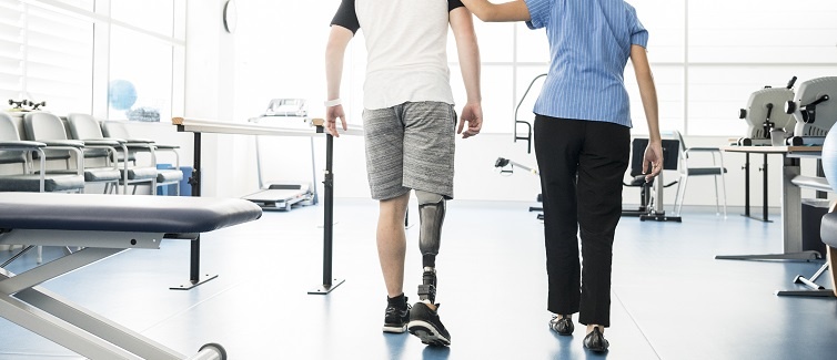 Coping with Amputation