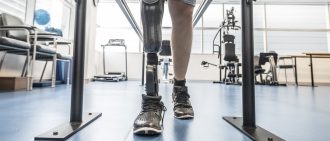 Man with prosthetic leg