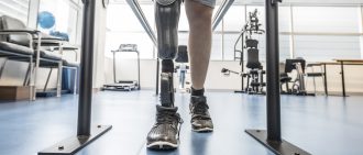 Man with prosthetic leg