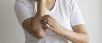 Stress rash