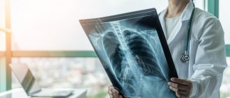 What You Need to Know About Lung Transplant Surgery