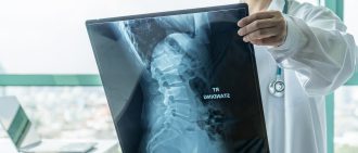 What Is Scoliosis?