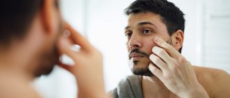 Chalazion or Stye: How You Can Tell the Difference