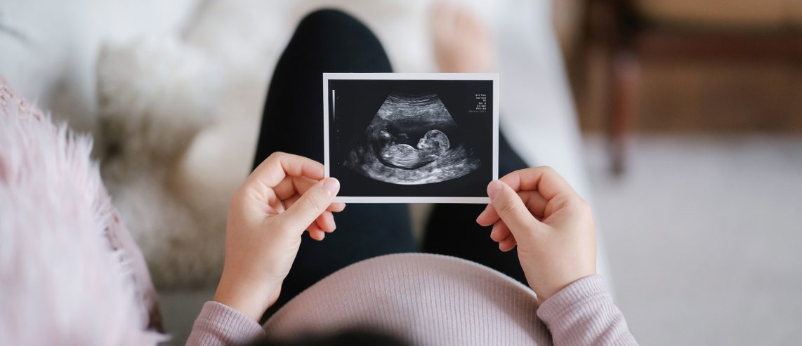 What Happens During a 20-Week Anatomy Scan