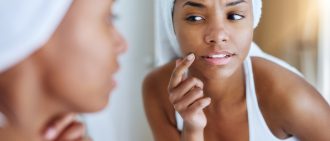 How to Treat Cold Sores