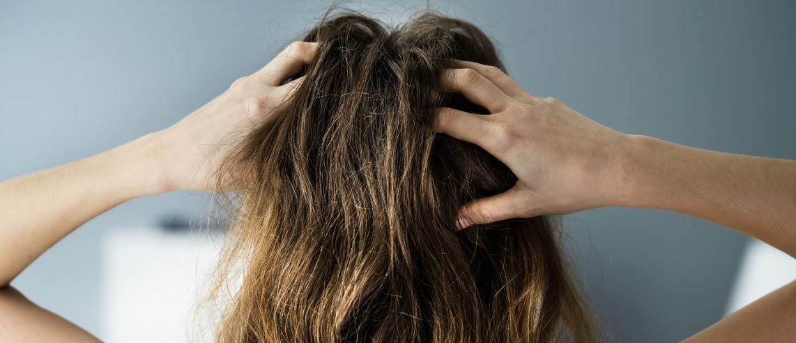 hair loss