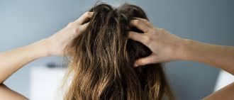 hair loss