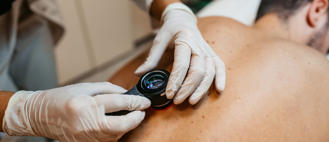 Different Types of Skin Cancer